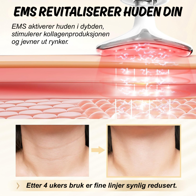 Dermalift™ | Løft, stram opp og jevn ut huden – helt uten nåler!