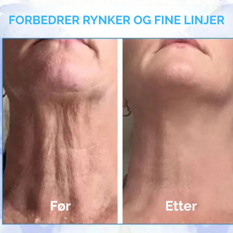 ClearSkin™ | Si farvel til crepe og slapp hud - forvandle utseendet ditt!