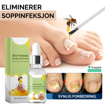 NailShield™ | Slutt å skade neglene for alltid