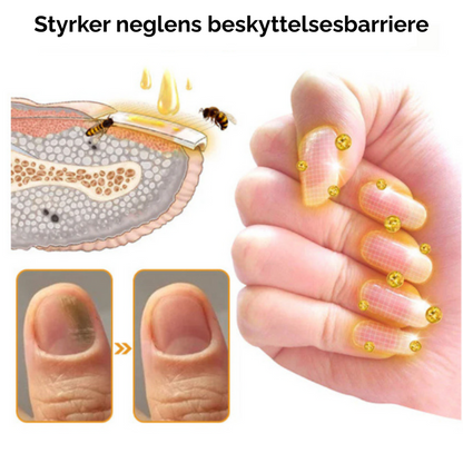 NailShield™ | Slutt å skade neglene for alltid