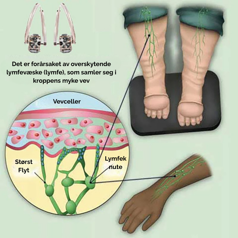 SlimGems™ | Øredobber med lymfatisk magnetterapi
