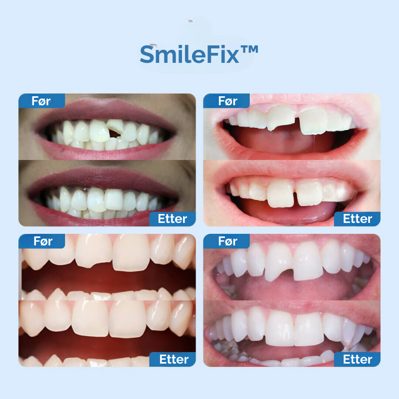 SmileFix™ | Raske reparasjoner for perfekte tenner!